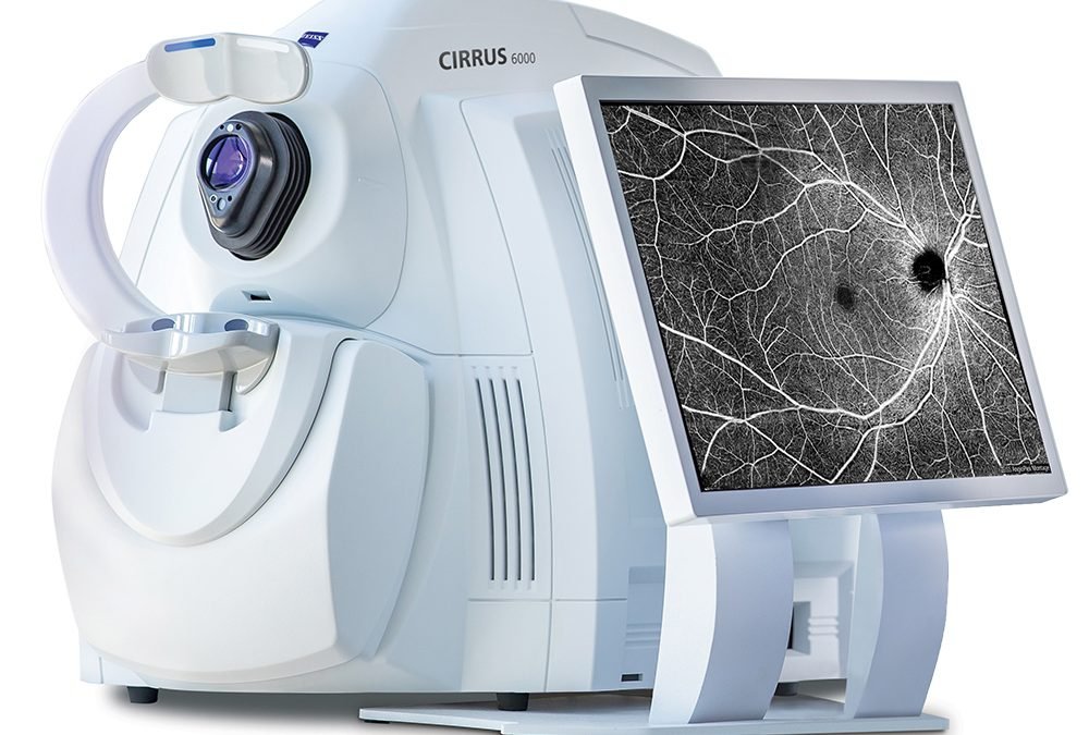 ZEISS desarrolla CIRRUS HD-OCT 8.0, la OCT inteligente más avanzada del mercado