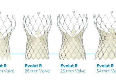 https://sisbc.com/wp-content/uploads/2020/01/EVOLUT-R-SYSTEM-Transcatheter-Aortic-Valve-Replacement-TAVR.pdf